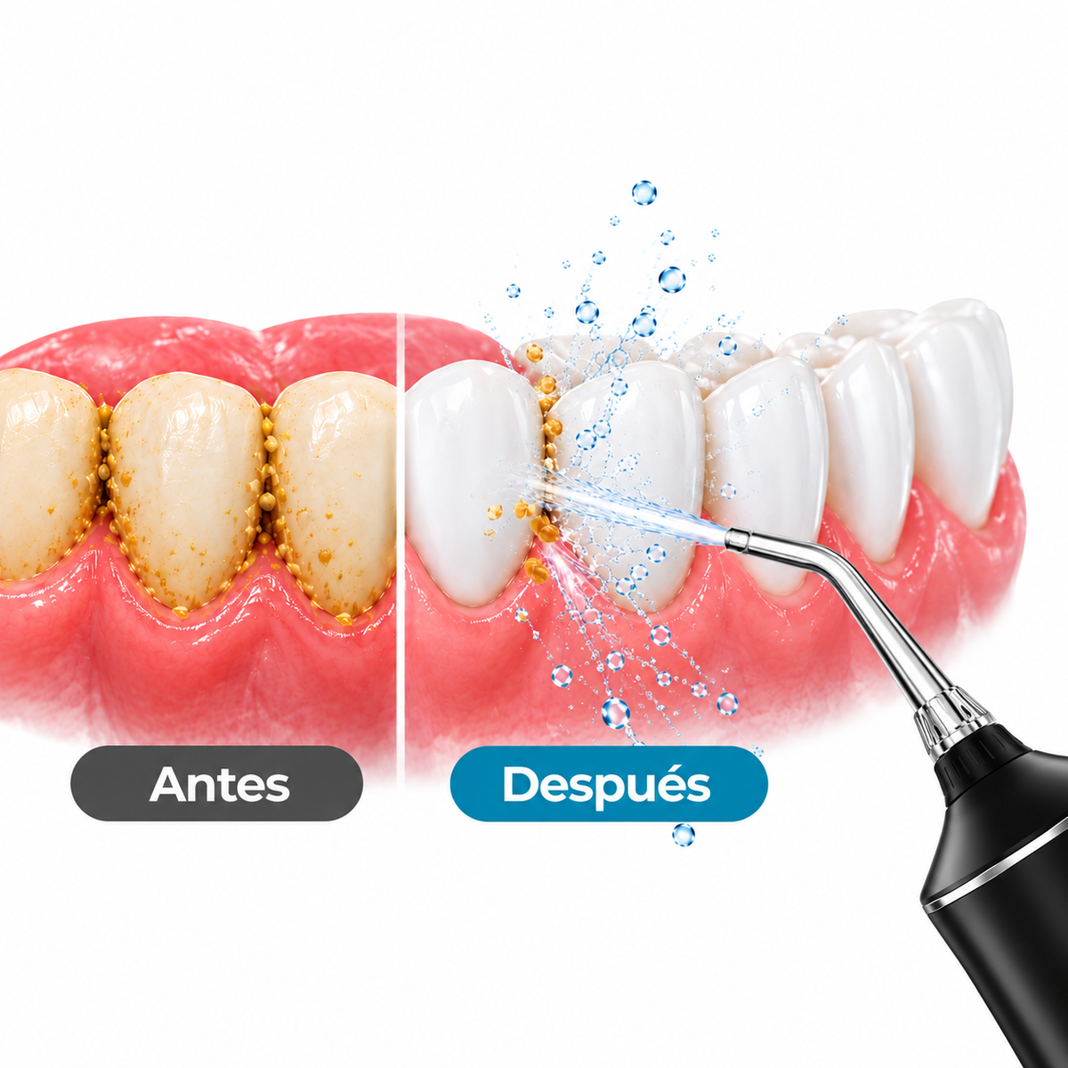 Irrigador Bucal de Limpieza Profunda