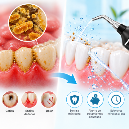 Irrigador Bucal de Limpieza Profunda