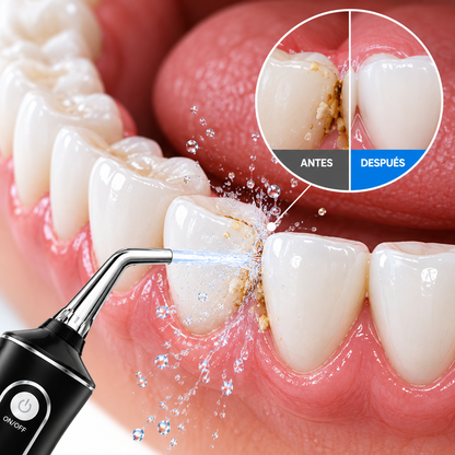 Irrigador Bucal de Limpieza Profunda