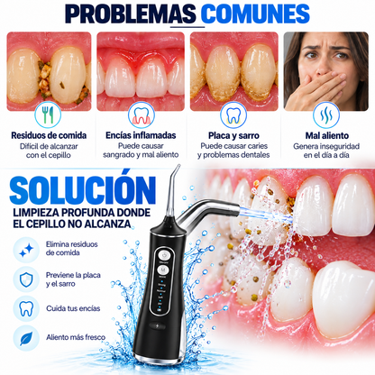 Irrigador Bucal de Limpieza Profunda